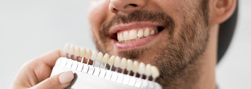 Dentist Matching Veneer Samples — Your Holistic Dentists in Casuarina, NSW