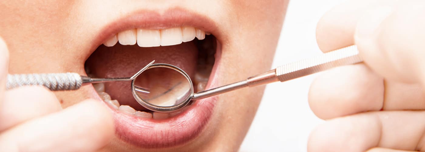 Doctor Checking Patient's Teeth — Your Holistic Dentists in Casuarina, NSW