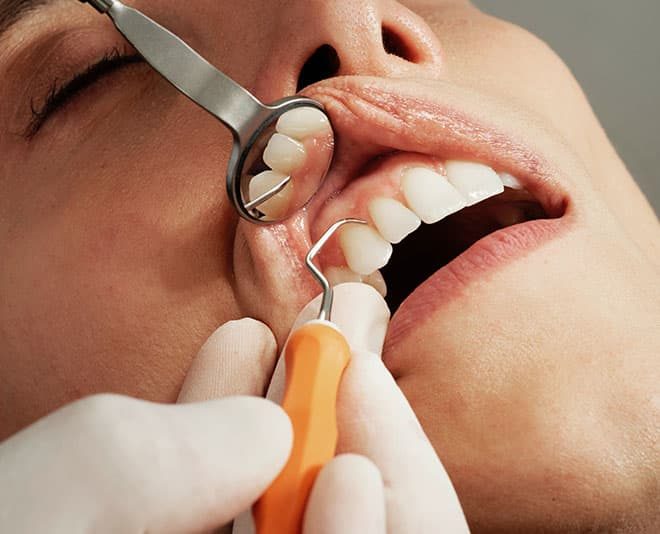 Close-up of Dental Treatment — Your Holistic Dentists in Casuarina, NSW