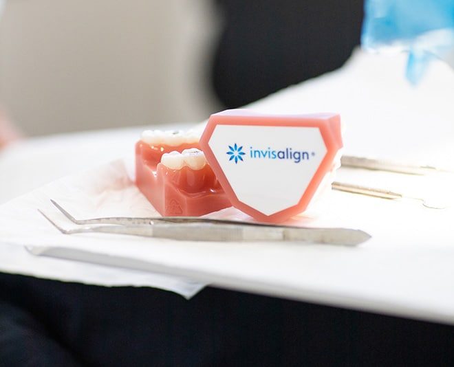 Close-up of Invisalign Sample — Your Holistic Dentists in Casuarina, NSW