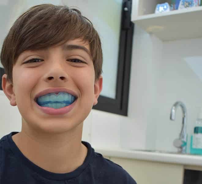 Kid with New Myobrace — Your Holistic Dentists in Casuarina, NSW