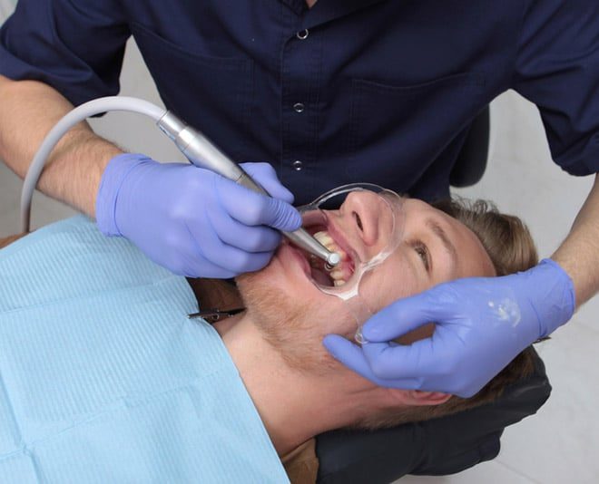 Dental Bonding Procedure on Man — Your Holistic Dentists in Casuarina, NSW