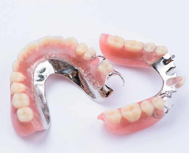 Removable Partial Denture — Your Holistic Dentists in Casuarina, NSW