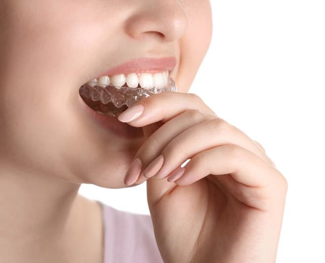 Woman Putting Invisalign in Mouth — Your Holistic Dentists in Casuarina, NSW